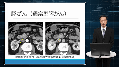 研修医のための画像診断 | 第4回　腹部画像　実践編