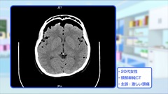 Dr.金井のCTクイズ　上級編 | 第2回　頭部：派手な画像 驚いてばかりではいられない その原因を探れ！