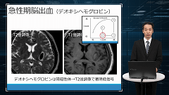 研修医のための画像診断 | 第5回　頭部画像　基礎編