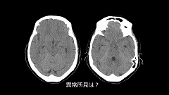 研修医のための画像診断 | 第6回　頭部画像　実践編