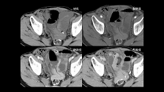 研修医のための画像診断 | 第8回 救急画像 胸部救急・外傷編 研修医のための画像診断 | 第8回 救急画像 胸部救急・外傷編