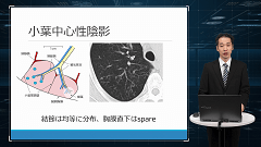 研修医のための画像診断 | 第9回 胸部CT 基礎編 研修医のための画像診断 | 第9回 胸部CT 基礎編