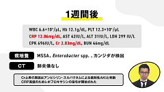 高齢者感染症ベストアンサー | 第5回 抗菌薬の使い方 高齢者感染症ベストアンサー | 第5回 抗菌薬の使い方