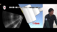 Dr.林の笑劇的救急問答 Season19 | 第6回 呼吸苦2:心不全の超音波は心エコーだけではない Dr.林の笑劇的救急問答 Season19 | 第6回 呼吸苦2:心不全の超音波は心エコーだけではない