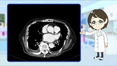 Dr.金井のCTクイズ　上級編 | 第5回　胸腹部：本来はCT診断ではないけれど