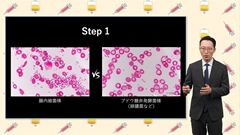 研修医のための抗菌薬の使い方 | 第10回　グラム陰性桿菌に対する治療
