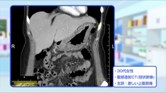 Dr.金井のCTクイズ　上級編 | 第7回　腹部：ポイントをつかみ次は一発診断
