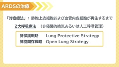 Dr.田中和豊の血液検査指南　臓器不全編 | 第4回　呼吸不全4　ARDS治療