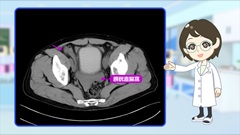 Dr.金井のCTクイズ　上級編 | 第9回　腹部：さまざまな病態を把握し次のステップへ