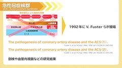 Dr.田中和豊の血液検査指南　臓器不全編 | 第6回　循環不全2　急性冠症候群