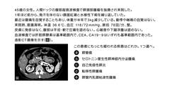 内科専門医試験　バーチャル模試2026 | 第1回　第1～20問