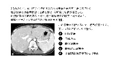 内科専門医試験　バーチャル模試2026 | 第6回　第101～120問