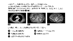 内科専門医試験　バーチャル模試2026 | 第7回　第121～140問