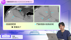 Dr.長谷の教育的症例から学ぶER画像リーディングパール | 第6回　胆嚢壁肥厚を見たら〇〇〇〇〇を考えろ！