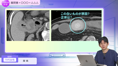 Dr.長谷の教育的症例から学ぶER画像リーディングパール | 第7回　腸閉塞+〇〇〇＝△△△