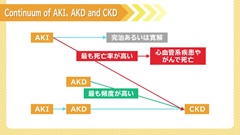Dr.田中和豊の血液検査指南　臓器不全編 | 第12回　腎不全3　慢性腎不全