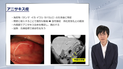 総合内科専門医試験オールスターレクチャー　消化器（消化管） | 第3回　消化管出血・腹部緊急疾患