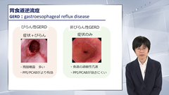 総合内科専門医試験オールスターレクチャー　消化器（消化管） | 第4回　機能性消化管疾患