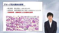総合内科専門医試験オールスターレクチャー　消化器（消化管） | 第5回　消化管感染症・炎症性腸疾患
