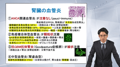 総合内科専門医試験オールスターレクチャー　腎臓 | 第5回　腎炎・ネフローゼ症候群