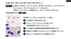 総合内科専門医試験バーチャル模試2026 | 第1回　1～20問