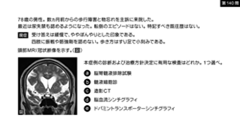総合内科専門医試験バーチャル模試2026 | 第7回　第121～140問