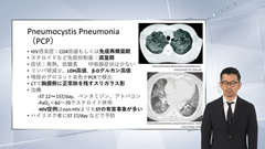 総合内科専門医試験オールスターレクチャー 感染症 | 第5回　真菌