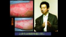 Dr.夏井の創傷治療大革命 | 消毒とガーゼをやめれば傷はすぐ治る