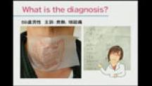 Dr.須藤のビジュアル診断学 | 第4回 頸部と甲状腺関連
