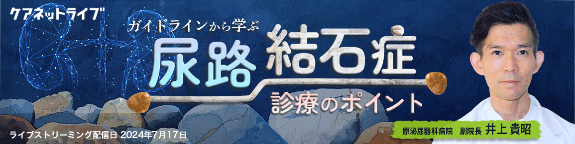 ガイドラインから学ぶ尿路結石症診療のポイント