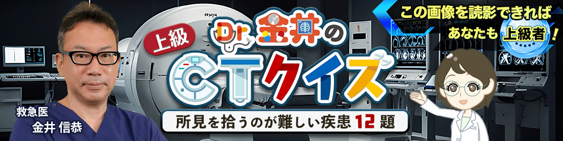 Dr.金井のCTクイズ 上級編 Dr.金井のCTクイズ 上級編
