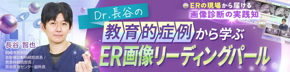 Dr.長谷の教育的症例から学ぶER画像リーディングパール