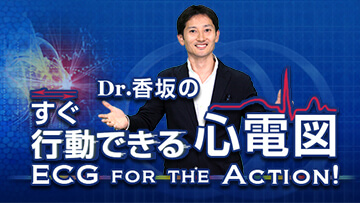 Dr.香坂のすぐ行動できる心電図　ECG for the Action! | 第5回　心電図の本丸　STの上昇