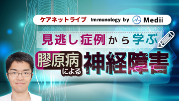 ケアネットライブ Immunology by Medii  | 第2回　見逃し症例から学ぶ 膠原病による神経障害