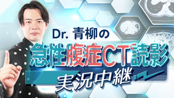 Dr.青柳の急性腹症CT読影 実況中継 | 第2回　最もコモンな原因疾患