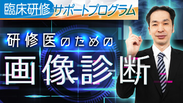 研修医のための画像診断