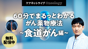 ケアネットライブOncology | 60分でまるっとわかる がん薬物療法 〜食道がん編〜