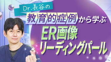 Dr.長谷の教育的症例から学ぶER画像リーディングパール