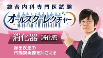 総合内科専門医試験オールスターレクチャー　消化器（消化管）